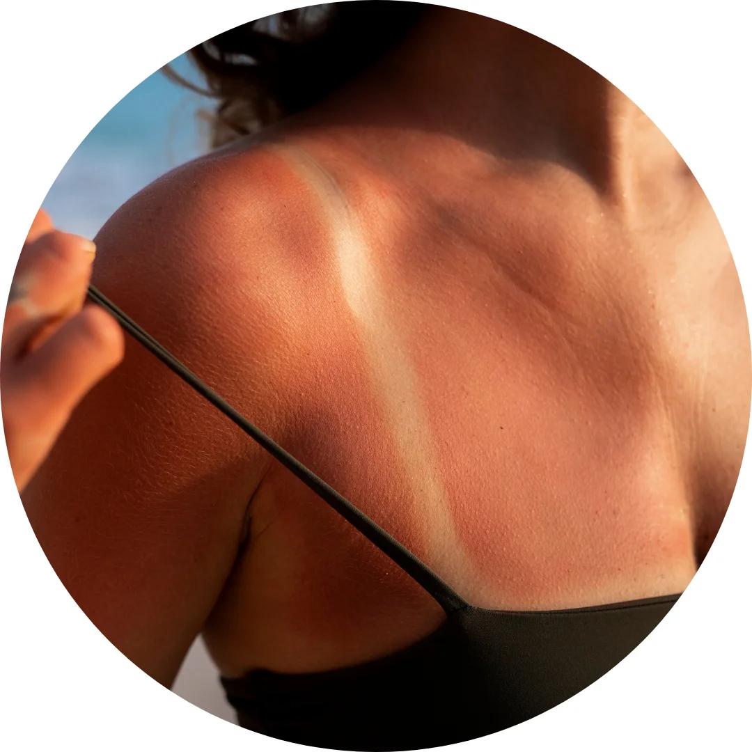 Tan Removal